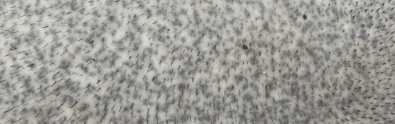 일반, PMU 머신 - 도트시술 결과 이미지